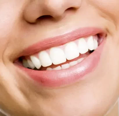 teeth-whitening